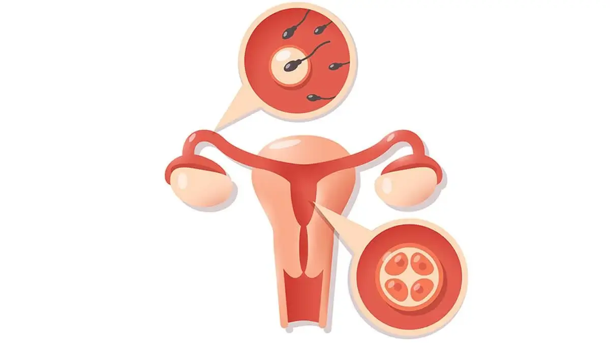 Can A Woman With Blocked Fallopian Tube Menstruate?