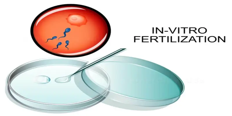 Is IVF Treatment A Protected Choice