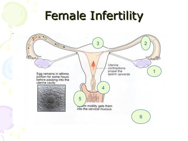 Is Infertility Just a Female’s Problem